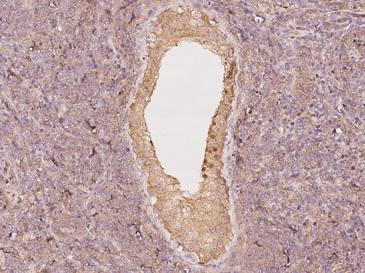 STAT4 Antibody