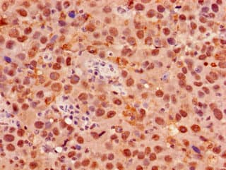 FOXK1 / MNF Antibody