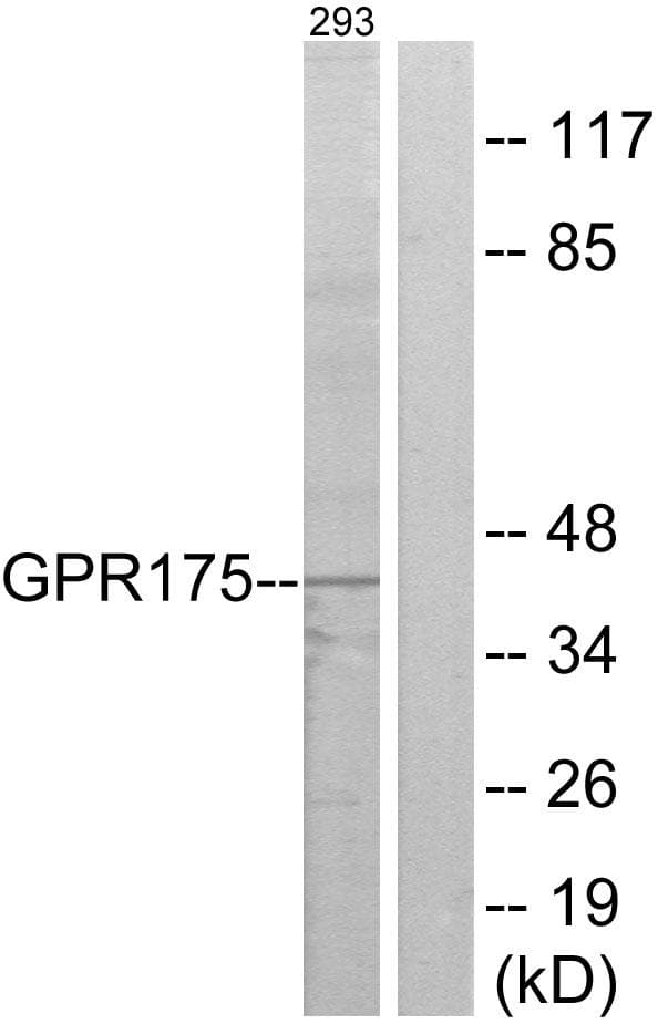 TPRA1 / GPR175 Antibody
