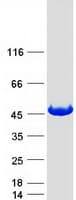 Human GMPPA Protein (Recombinant Myc-DDK (Flag))