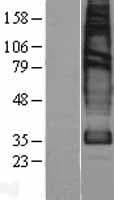 Human SLC22A18 Protein (Over-Expression Lysate Myc-DDK (Flag))