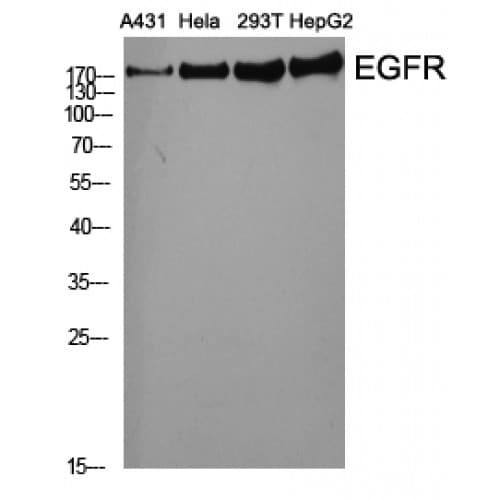 EGFR Antibody (960-1040 aa)