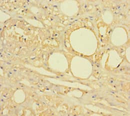 Polyclonal Rabbit anti-Human HTR2A / 5-HT2A Receptor Antibody