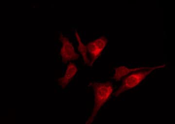 HUNK / B19 Antibody