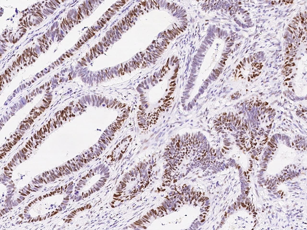 MSH6 Antibody (clone 021, Preservative Free)