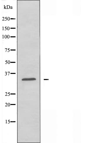Polyclonal Rabbit anti-Human CYSLT2 / CYSLTR2 Antibody (IF, WB)