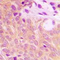 ETK / BMX Antibody (C-Terminus)