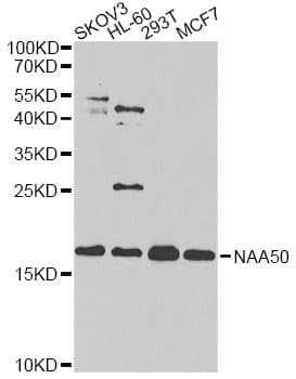NAA50 / NAT13 / SAN Antibody