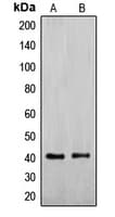 EXOG / ENDOGL1 Antibody (Internal)