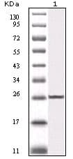 IKBIP Antibody (clone 10A2C5B3)