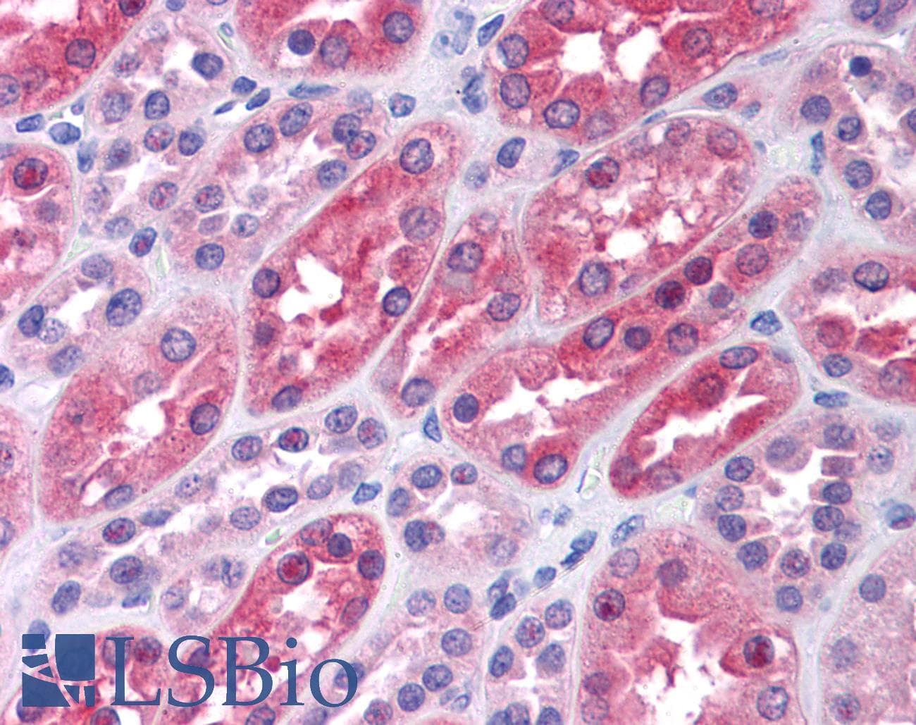 IHC-plus™ KPI-2 / LMTK2 Antibody (clone 3G1)