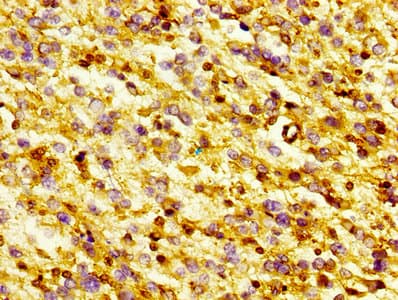 GSN / Gelsolin Antibody (aa28-782)