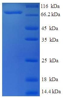 Human ASH2L / ASH2 Protein (Recombinant His-SUMO)