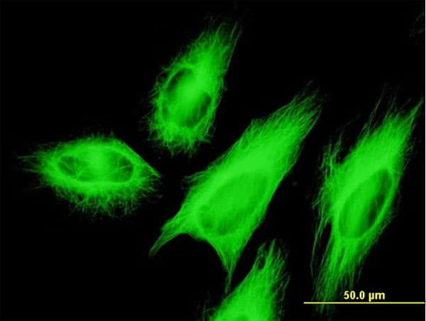IHC-plus™ Monoclonal Mouse anti-Human TUBB2A / Tubulin Beta 2A Antibody (clone 3F9, IHC, IF, WB)