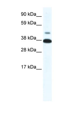 NR1A2 / THRB Antibody (aa37-86)