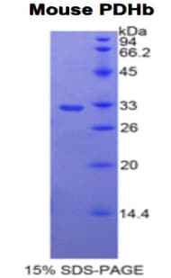 Mouse PDHB Protein (Recombinant His)