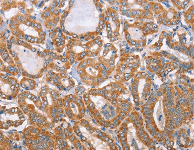 MTMR7 Antibody