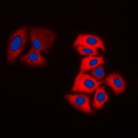 Polyclonal Rabbit anti-Human MOK / RAGE Antibody (Internal, IF, WB)