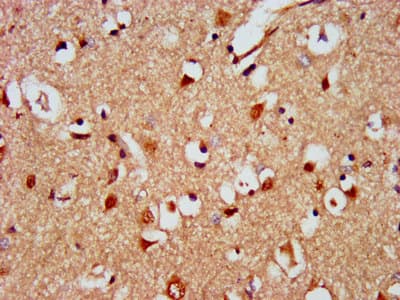 KIAA0319 Antibody