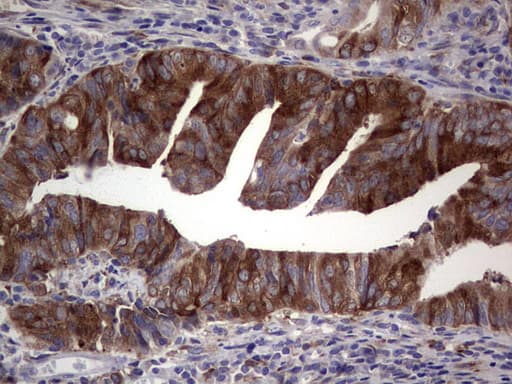 Monoclonal Mouse anti-Human R1 / RRM1 Antibody (clone OTI1F9, aa541-792, IHC)