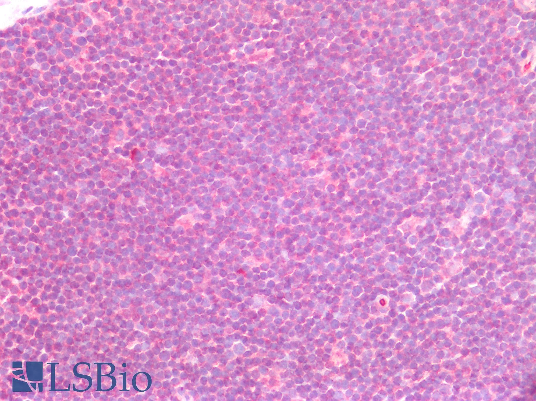 PathPlus™ Polyclonal Rabbit anti-Human CD274 / B7-H1 / PD-L1 Antibody (IHC)