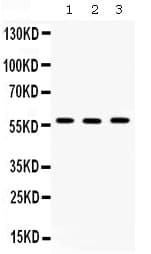 CCT2 / CCT Beta Antibody