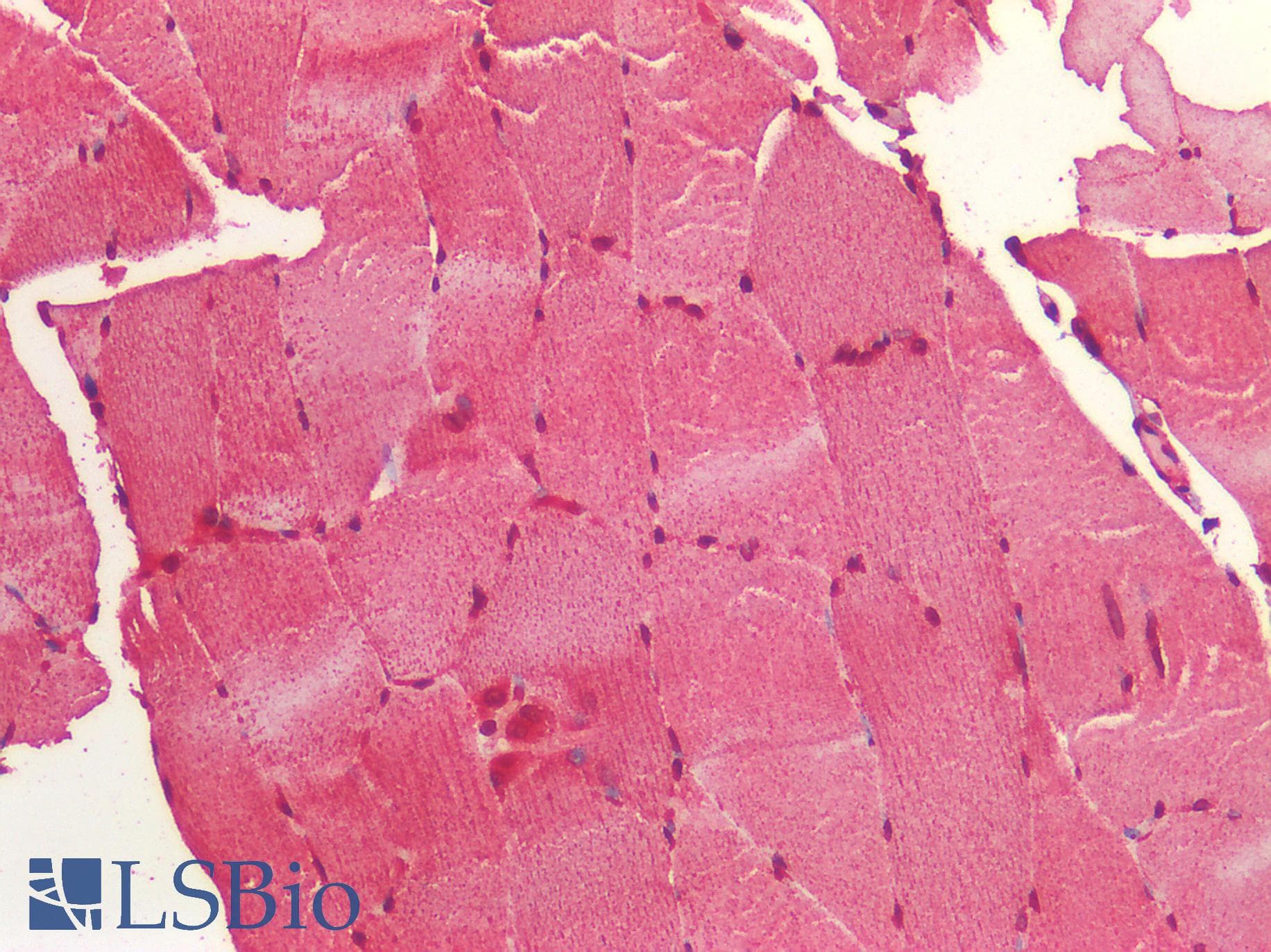 IHC-plus™ Polyclonal Rabbit anti-Human IGF1R / IGF1 Receptor Antibody (IHC)