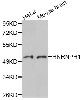 Polyclonal Rabbit anti-Human HNRNPH1 / hnRNP H Antibody (WB)