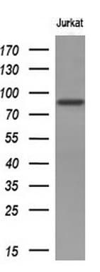 Monoclonal Mouse anti-Human AR / Androgen Receptor Antibody (clone OTI1D3, aa420-659, IHC, WB)