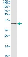 IHC-plus™ Monoclonal Mouse anti-Human ANXA5 / Annexin V Antibody (clone 1F4-1A5, IHC, IF, WB)