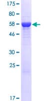 Human GPD1L Protein (Recombinant GST)