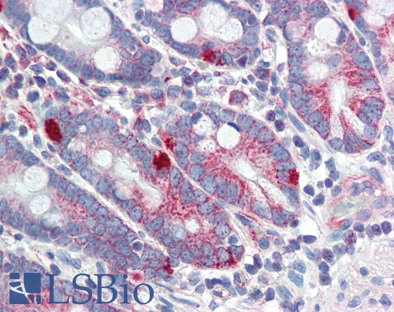 MED4 Antibody (aa146-195)