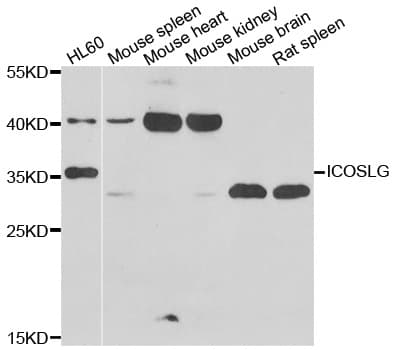 CD275 / B7-H2 / ICOS Ligand Antibody