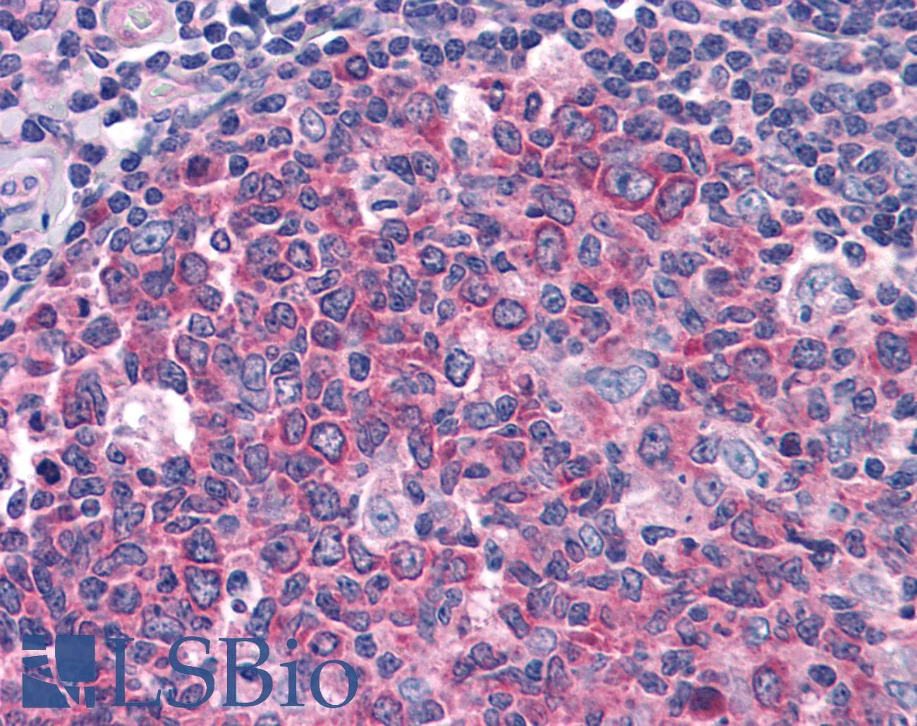 PathPlus™ Polyclonal Rabbit anti-Human IDE Antibody (IHC, WB)