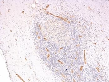VWF / Von Willebrand Factor Antibody (clone 3E2D10 + VWF635)