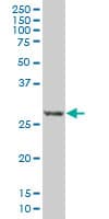 RCAN1 / DSCR1 Antibody (clone 1G7)