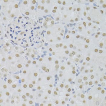SFN / Stratifin / 14-3-3 Sigma Antibody