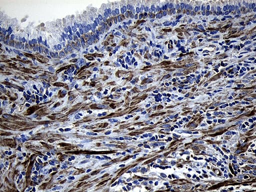 MLC3F / MYL1 Antibody (aa2-150, clone OTI4E3, Carrier-free)