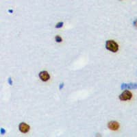 HnRNPLL / HNRPLL Antibody (Internal)