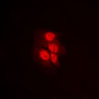 MAP2K1 / MKK1 / MEK1 Antibody (phospho-Thr292)