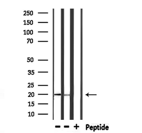 FTL / Ferritin Light Chain Antibody