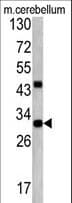ZWINT Antibody (aa59-88)