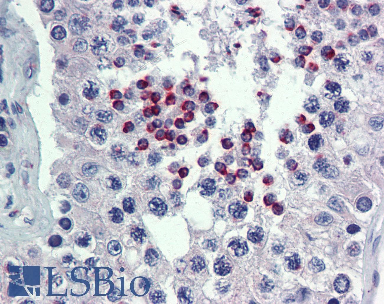 IHC-plus™ Polyclonal Rabbit anti-Human POU5F1 / OCT4 Antibody (IHC, IF, WB)