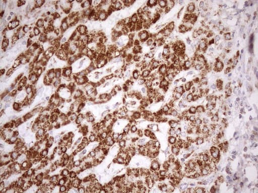 Monoclonal Mouse anti-Human SDHB Antibody (clone OTI3F5, IHC, WB)