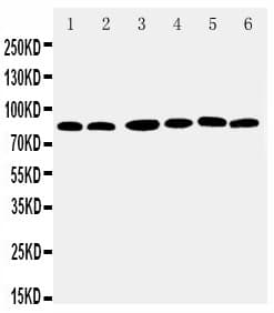 Polyclonal Rabbit anti-Human RPS6KA1 / RSK1 Antibody (aa721-735, WB)