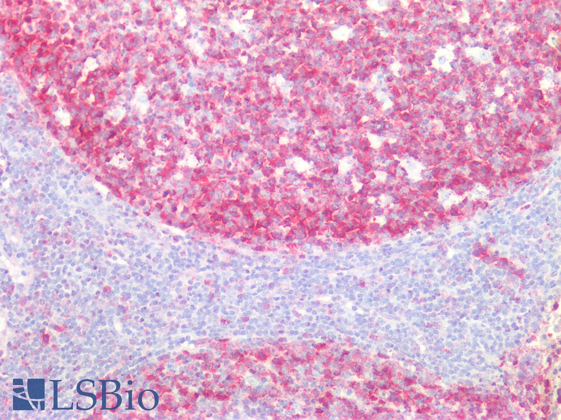 PathPlus™ STMN1 / Stathmin / LAG Antibody