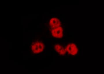 NFKB1 / NF-Kappa-B Antibody