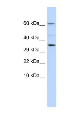 Polyclonal Rabbit anti-Human KCNIP2 / KCHIP2 Antibody (aa35-84, IHC, WB)