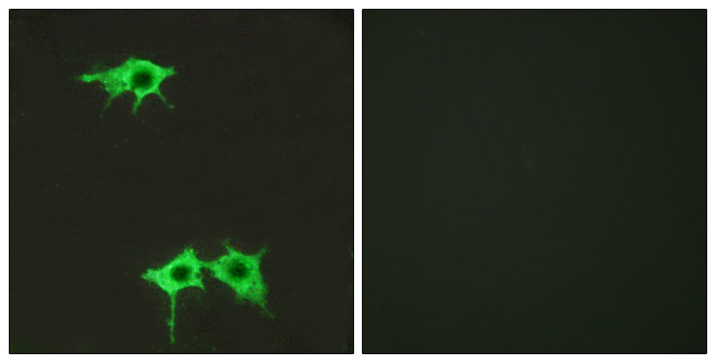 FZD4 / Frizzled 4 Antibody (aa131-180)