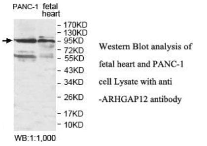 ARHGAP12 Antibody (aa2-185)